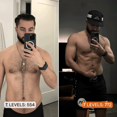 3. Watch Your Chest Flatten as Excess Estrogen Clears Out